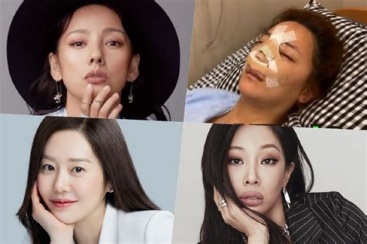 Korean Celebrity Plastic Surgery: Insights Into The Industry
