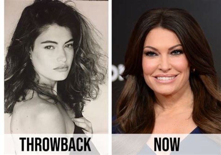 The Evolution Of Kimberly Guilfoyle: Before And After Pictures Unveiled